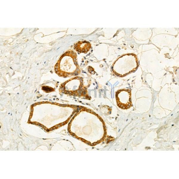 Kindlin 2 Antibody - DF12078 at 1/100 staining Human normal tissues adjacent to mammary cancer by IHC-P.