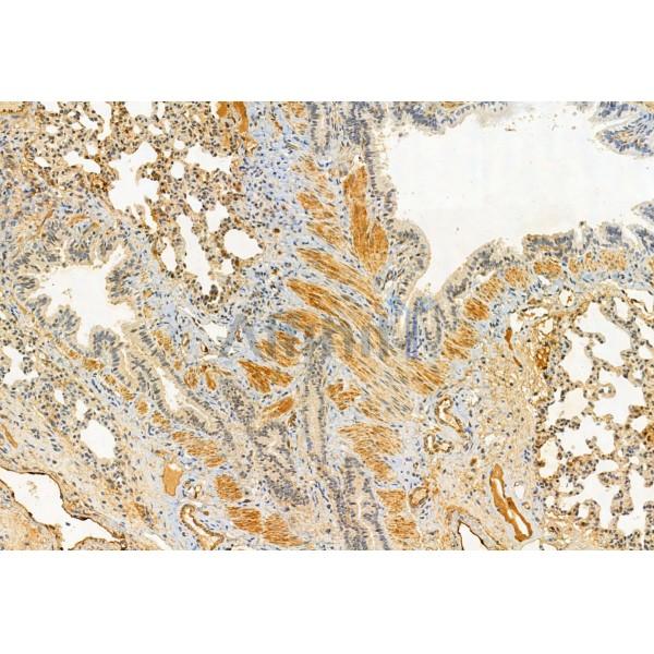 Kindlin 2 Antibody - DF12078 at 1/100 staining Rat lung tissue by IHC-P.