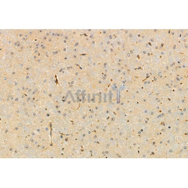 Piezo1 Antibody - DF12083 at 1/100 staining Mouse brain tissue by IHC-P.