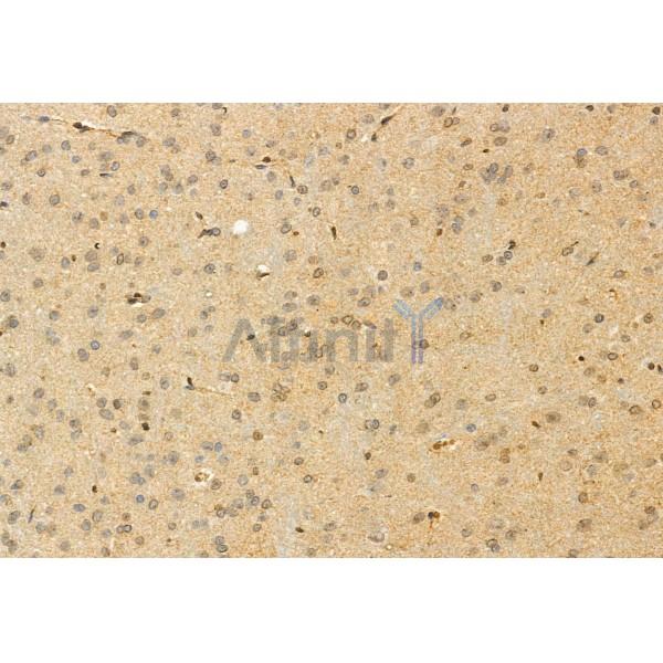 Piezo1 Antibody - DF12083 at 1/100 staining Rat brain tissue by IHC-P.