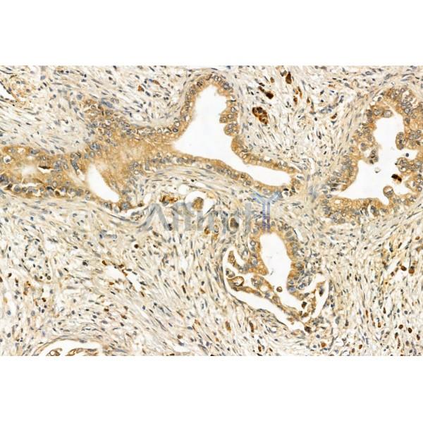Spartin, SPG20 Antibody - DF12086 at 1/100 staining Human normal tissues adjacent to pancreatic cancer by IHC-P.
