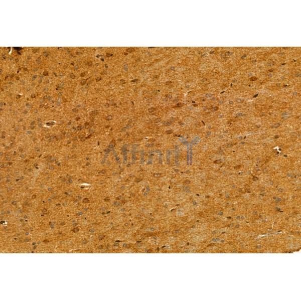 SULT4A1 Antibody - DF12088 at 1/100 staining Rat brain tissue by IHC-P.