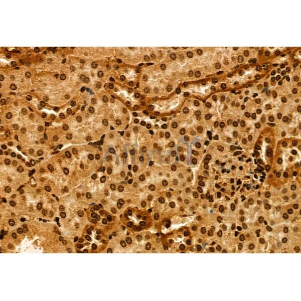 TET2 Antibody - DF12089 at 1/100 staining Mouse lung tissue by IHC-P.