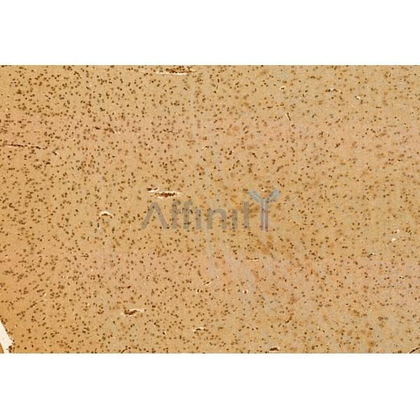 TET2 Antibody - DF12089 at 1/100 staining Rat brain tissue by IHC-P.