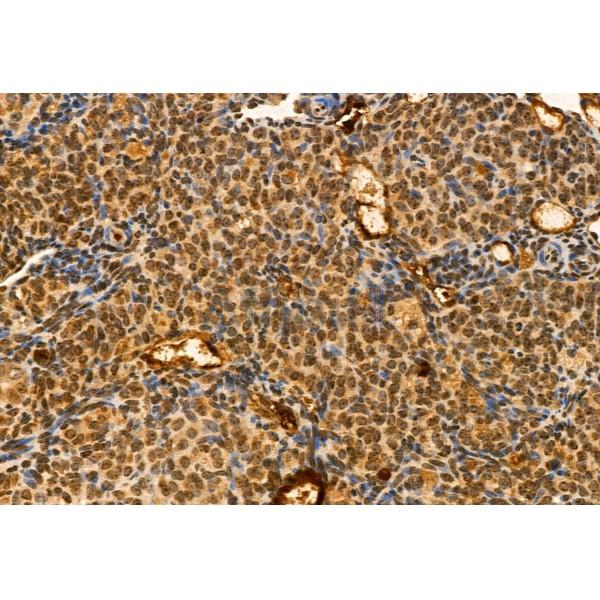 TET2 Antibody - DF12089 at 1/100 staining Mouse kidney tissue by IHC-P.