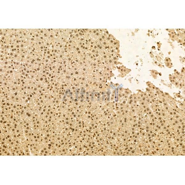 TET2 Antibody - DF12089 at 1/100 staining Rat liver tissue by IHC-P.