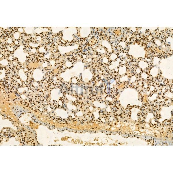 AP3B1 Antibody - DF12092 at 1/100 staining Rat lung tissue by IHC-P.