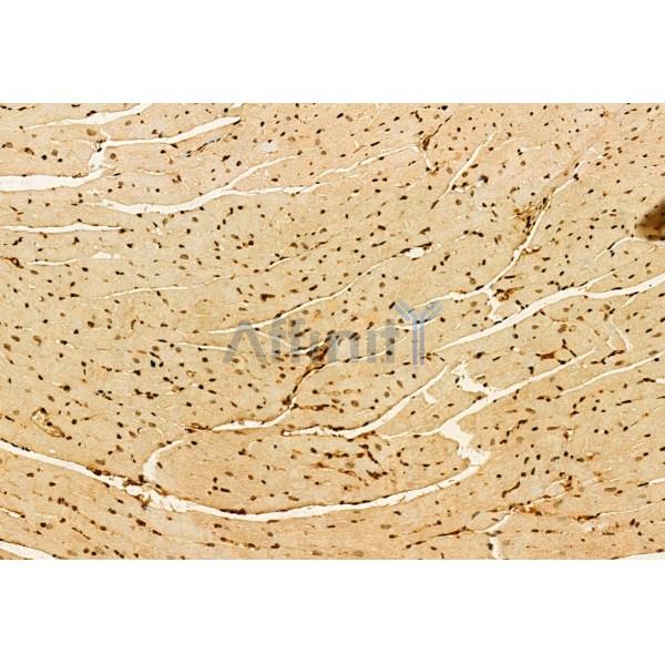 AP3B1 Antibody - DF12092 at 1/100 staining Mouse heart tissue by IHC-P.