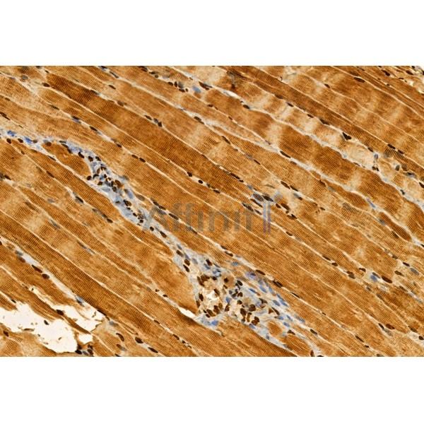 AP3B1 Antibody - DF12092 at 1/100 staining Rat muscle tissue by IHC-P.