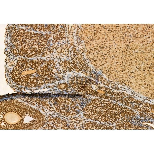 AP3B1 Antibody - DF12092 at 1/100 staining Rat ovary tissue by IHC-P.