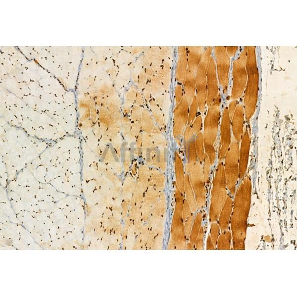 AP3B1 Antibody - DF12092 at 1/100 staining Rat skin tissue by IHC-P.