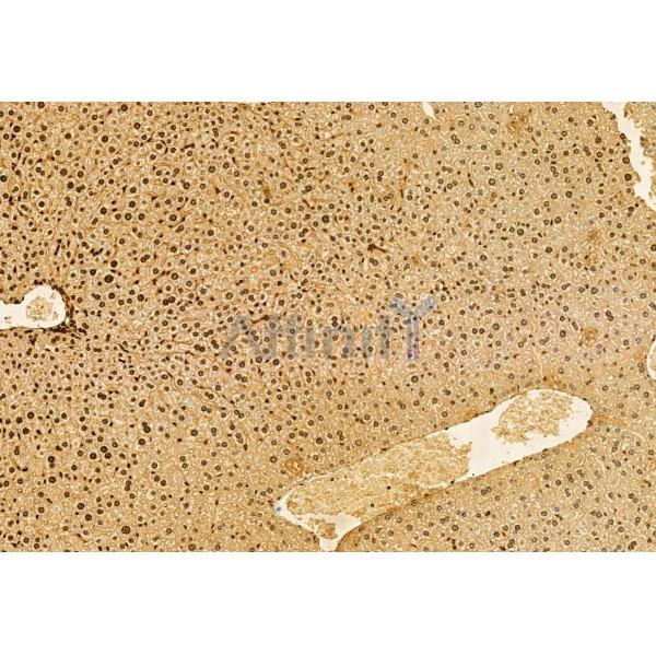 AP3B1 Antibody - DF12092 at 1/100 staining Mouse liver tissue by IHC-P.