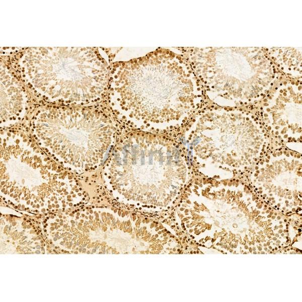 AP3B1 Antibody - DF12092 at 1/100 staining Rat testis tissue by IHC-P.