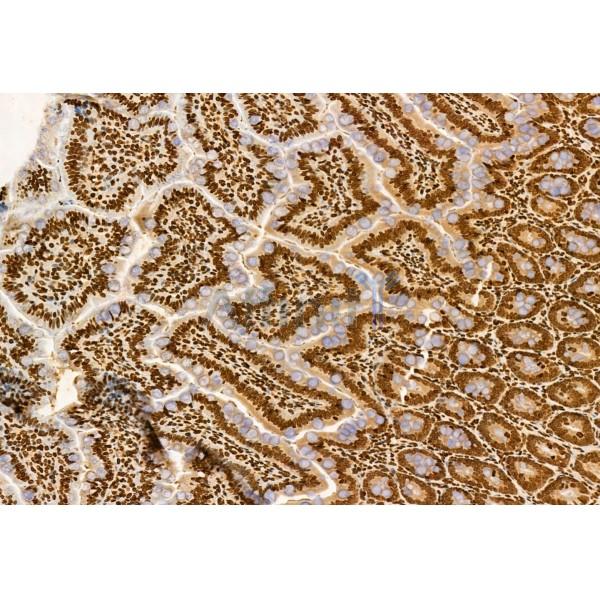 AP3B1 Antibody - DF12092 at 1/100 staining Rat colon tissue by IHC-P.