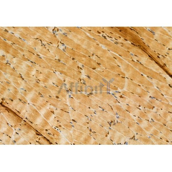 BBS2 Antibody - DF12093 at 1/100 staining Rat muscle tissue by IHC-P.