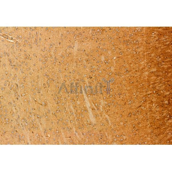 Centrin 1 Antibody - DF12095 at 1/100 staining Rat brain tissue by IHC-P.