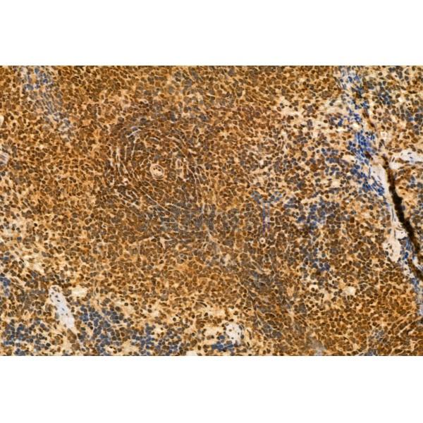 DEK Antibody - DF12097 at 1/100 staining Rat spleen tissue by IHC-P.