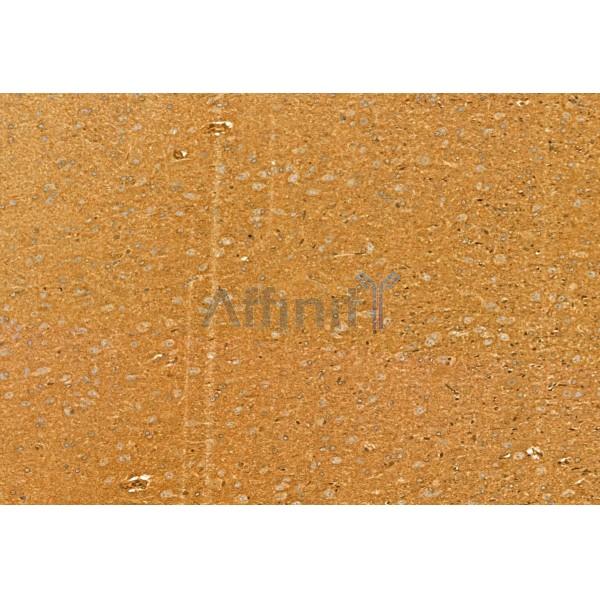 GOLPH3 Antibody - DF12099 at 1/100 staining Rat brain tissue by IHC-P.