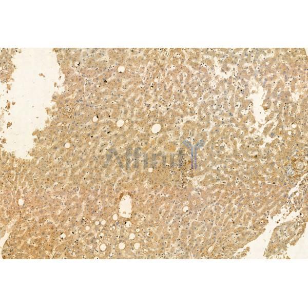 AGGF1 Antibody - DF12109 at 1/100 staining Human normal tissues adjacent to liver cancer by IHC-P.
