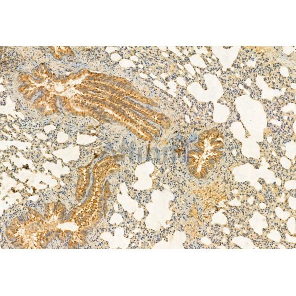 C9orf72 Antibody - DF12112 at 1/100 staining Rat lung tissue by IHC-P.