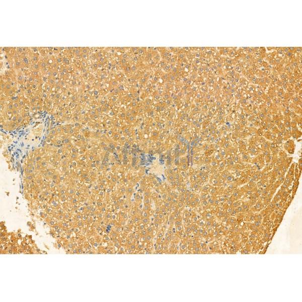 C9orf72 Antibody - DF12112 at 1/100 staining Rat liver tissue by IHC-P.