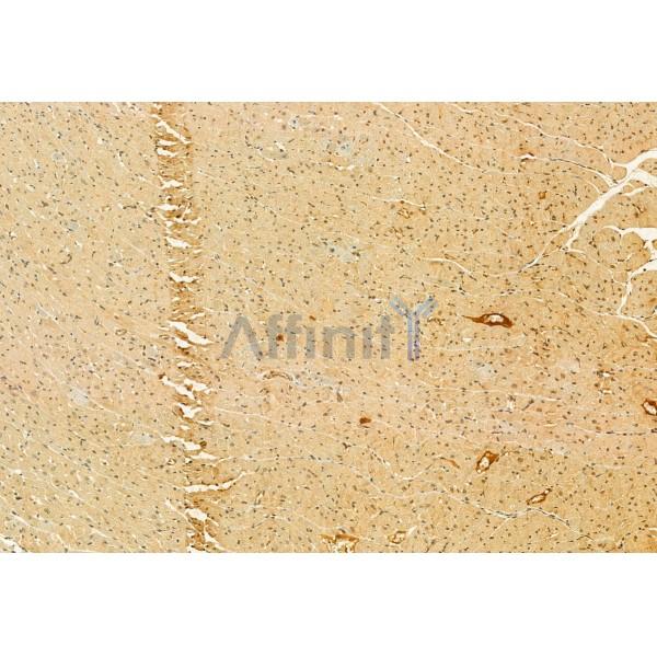 C9orf72 Antibody - DF12112 at 1/100 staining Rat heart tissue by IHC-P.