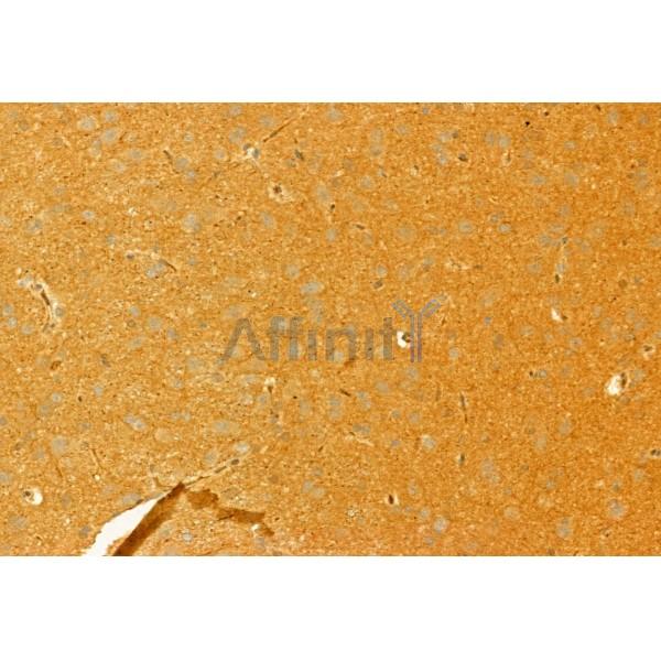 Osteocalcin Antibody - DF12303 at 1/100 staining Rat brain tissue by IHC-P.
