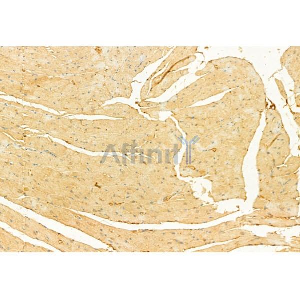 Osteocalcin Antibody - DF12303 at 1/100 staining Mouse heart tissue by IHC-P.