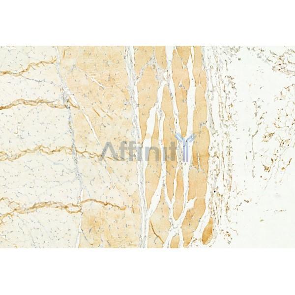 Osteocalcin Antibody - DF12303 at 1/100 staining Rat skin tissue by IHC-P.