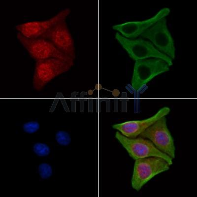 FBXO7 Antibody - DF13008 staining Hela cells by IF/ICC.