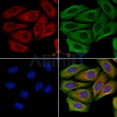 FUT6 Antibody - DF13025 staining Hela cells by IF/ICC.