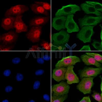 GABPB1 Antibody - DF13029 staining Hela cells by IF/ICC.