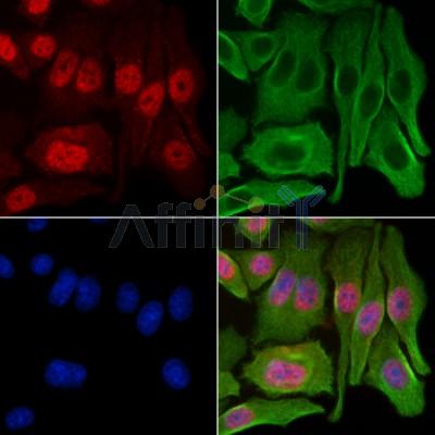 GCHFR Antibody - DF13035 staining Hela cells by IF/ICC.