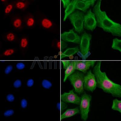 HIST1H1T Antibody - DF13061 staining Hela cells by IF/ICC.