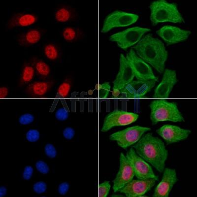 HMBOX1 Antibody - DF13062 staining Hela cells by IF/ICC.
