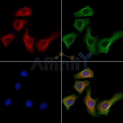 KIF19 Antibody - DF13109 staining Hela cells by IF/ICC.
