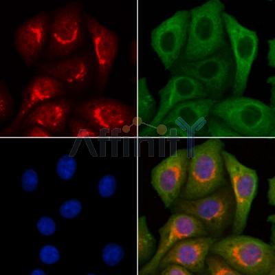 LETM2 Antibody - DF13128 staining Hela cells by IF/ICC.