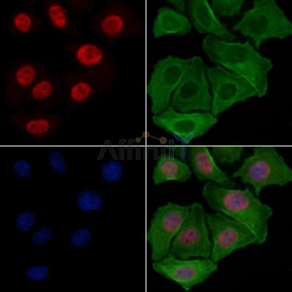 CRM1 Antibody - DF13364 staining Hela cells by IF/ICC.