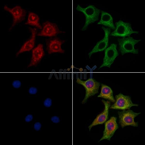 TIM 4 Antibody - DF13636 staining HepG2 cells by IF/ICC.