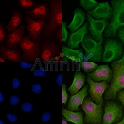 CENPN Antibody - DF2315 staining Hela cells by IF/ICC.