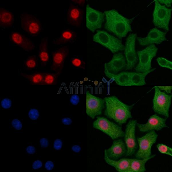 SNAPC4 Antibody - DF2405 staining HepG2 cells by IF/ICC.