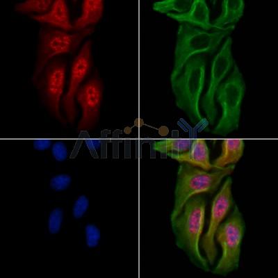 AEBP1 Antibody - DF2427 staining Hela cells by IF/ICC.
