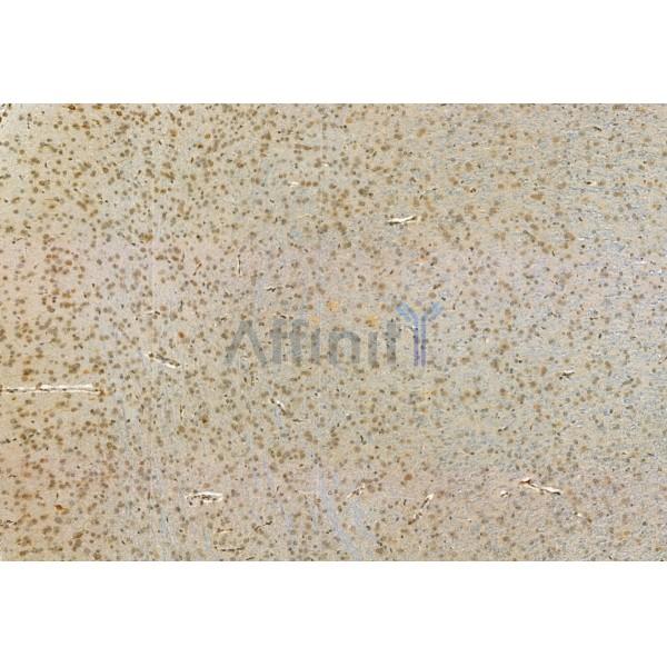 MYOCD Antibody - DF2434 at 1/100 staining Rat brain tissue by IHC-P.