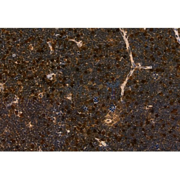 MYOCD Antibody - DF2434 at 1/100 staining Rat heart tissue by IHC-P.