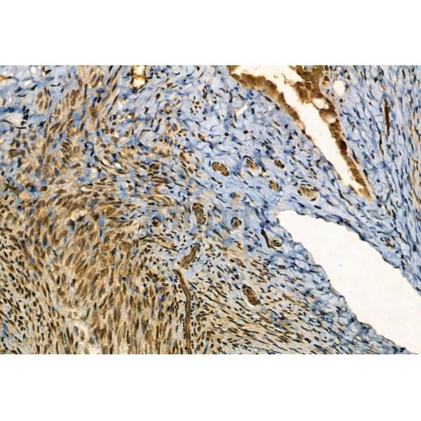 MYOCD Antibody - DF2434 at 1/100 staining Rat ovary tissue by IHC-P.