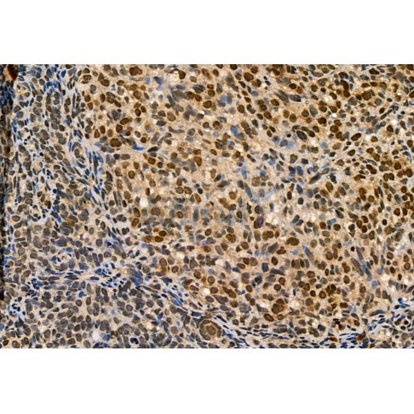 MYOCD Antibody - DF2434 at 1/100 staining Mouse ovary tissue by IHC-P.