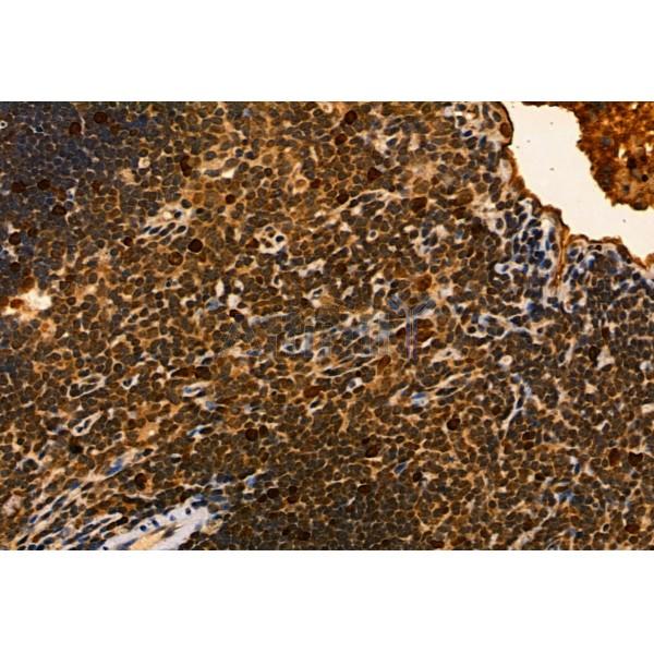 MYOCD Antibody - DF2434 at 1/100 staining Mouse thymus tissue by IHC-P.