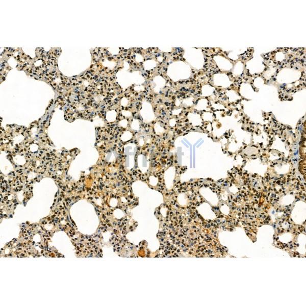 MYOCD Antibody - DF2434 at 1/100 staining Rat spleen tissue by IHC-P.