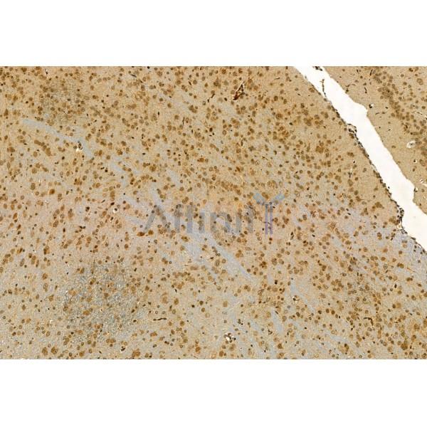 MYOCD Antibody - DF2434 at 1/100 staining Mouse brain tissue by IHC-P.