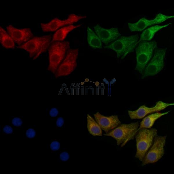 TCHP Antibody - DF2457 staining HepG2 cells by IF/ICC.